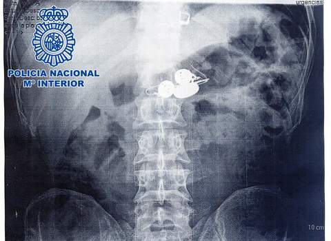 Noticia de Almería 24h: Detenido un “murciglero” y recuperadas más de 50 piezas de joyería, algunas del interior del organismo del detenido