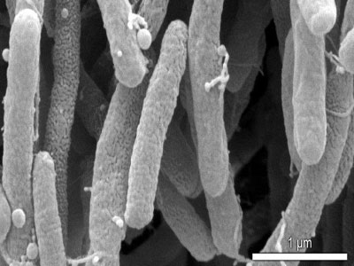 Andaluca libre de la bacteria Xylella segn ms de 600 anlisis del Laboratorio de Sanidad Vegetal de La Mojonera 