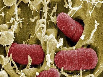 Noticia de Almera 24h: Con el mal uso del antibitico las bacterias aprenden como resistir