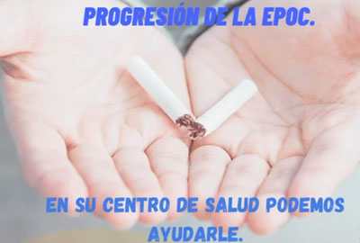 Noticia de Almera 24h: Distrito Sanitario Almera: La EPOC es una enfermedad respiratoria crnica y progresiva que dificulta la respiracin